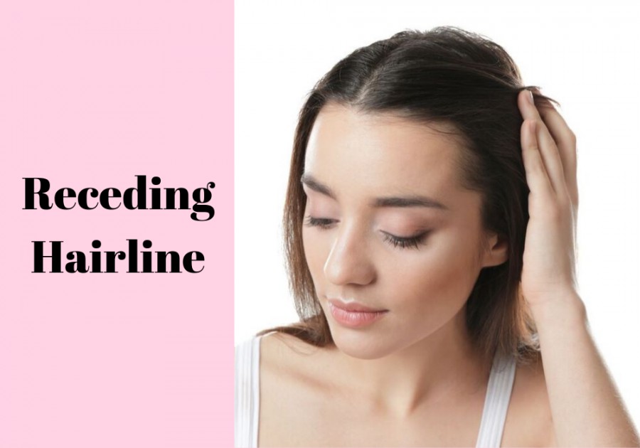 9 Different Types Of Hairlines | Low, Uneven, High, Receding and More!