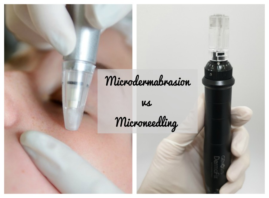 microdermabrasion vs microneedling