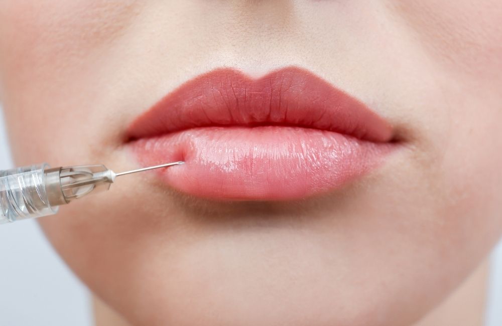 4 Most Popular Lip Fillers that Make Your Pout Last Really Long