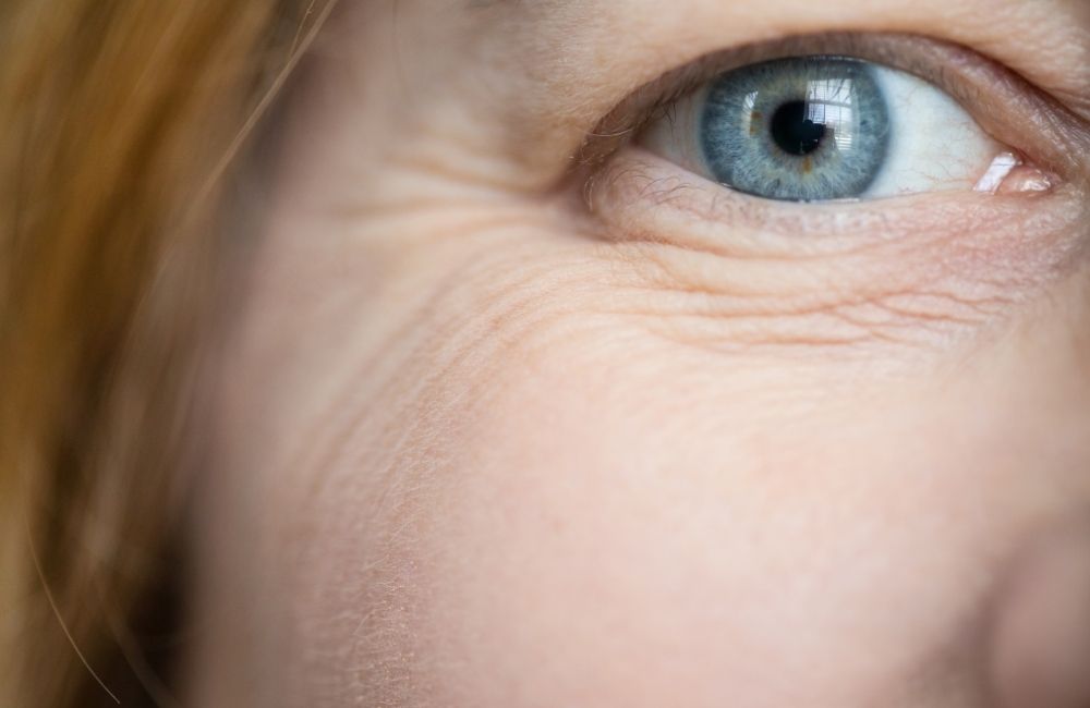 how-to-prevent-get-rid-of-under-eye-wrinkles-naturally