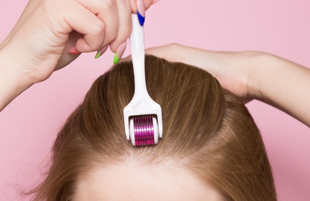 Do Derma Rollers Work for Hair Loss