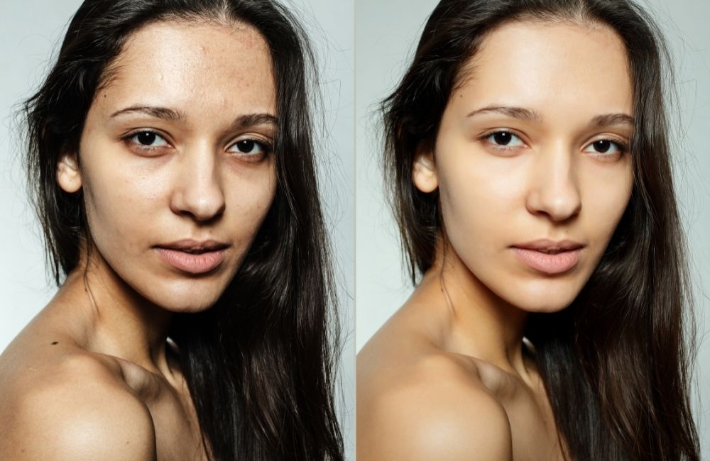 Hydrating Facial Before and After