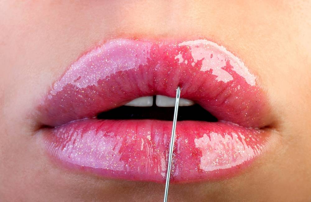 Surgical Ways to Get Bigger Lips