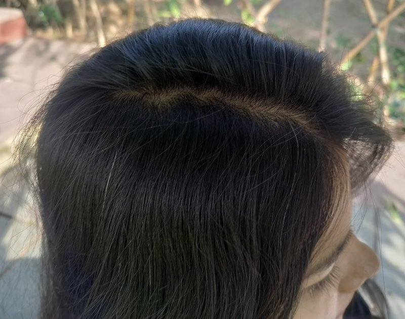 currentbody led hair growth helmet after results