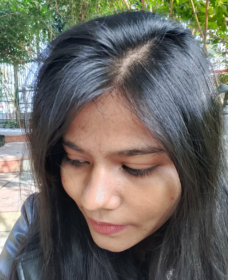 currentbody led hair growth helmet before results